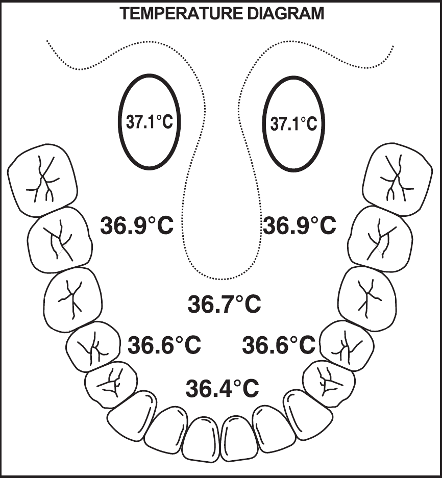 DIAGRAMA DE TEMPERATURA