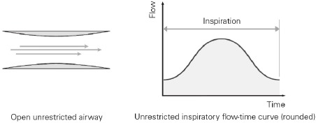 Mediciones del modo AutoSet: inspiraci&oacute;n normal de las v&iacute;as respiratorias