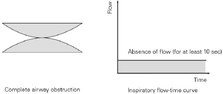 Mediciones del modo AutoSet: apnea obstructiva