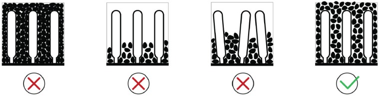 Colocaci&oacute;n de las piedras