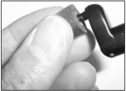 USO DE TAPONES PARA LOS O&Iacute;DOS NFMI - Paso 2