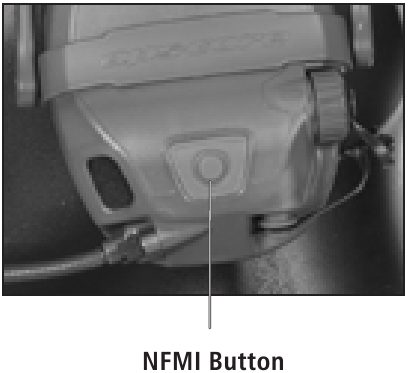 USO DE TAPONES PARA LOS O&Iacute;DOS NFMI - Paso 5