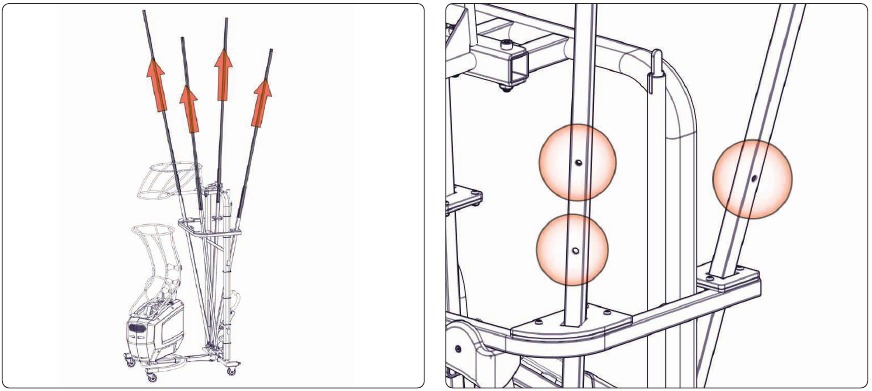 Sistema de red - Paso 1 - Extender los postes