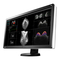 Eizo RadiForce Serie