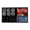Barco MDSC-8258 Serie