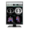 Eizo RadiForce RX360
