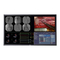 Barco MDSC-8358 RL