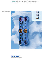 Synthes Vectra Manual Del Usuario