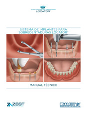 Zest LOCATOR Manual Tecnico